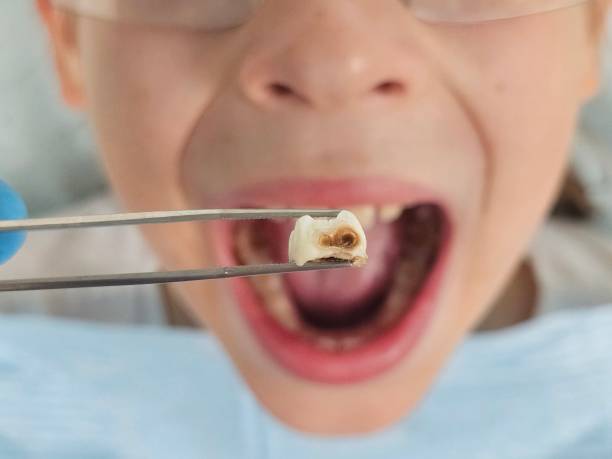 Best Pediatric Emergency Dentist in Collinsville, CT